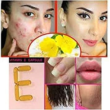 50 Evion Capsules Vitamin E for Glowing Face,Strong Hair,Acne,Nails, Glowing Skin 400mg Nirvana Guru
