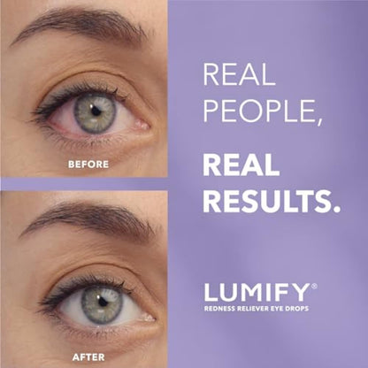 LUMIFY Eye Drops for Red Eyes, Redness Reliever for Brighter Looking Eyes, Works in 1 Minute & Lasts Up to 8 Hours, Eye Drops, 0.08 Fl Oz (2.5 mL), Packaging May Vary