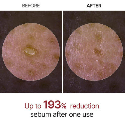 Peel Shot Glow Black Rice Peeling Ampoule, Soft Exfoliating Face and Body Scrub Dead Skin Cells, Blackheads Remover for All Skin Types korean skin care 80ml Nirvana Guru