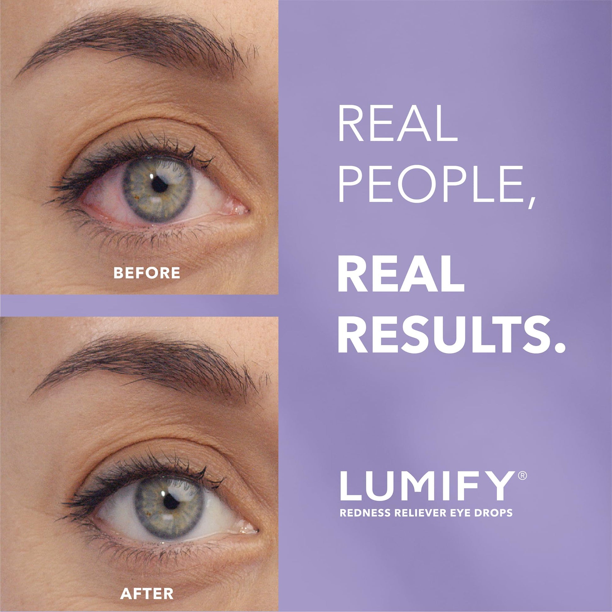 LUMIFY Eye Drops for Red Eyes, Redness Reliever for Brighter Looking Eyes, Works in 1 Minute & Lasts Up to 8 Hours, Eye Drops, 0.25 Fl Oz (7.5mL), Packaging May Vary Nirvana Guru