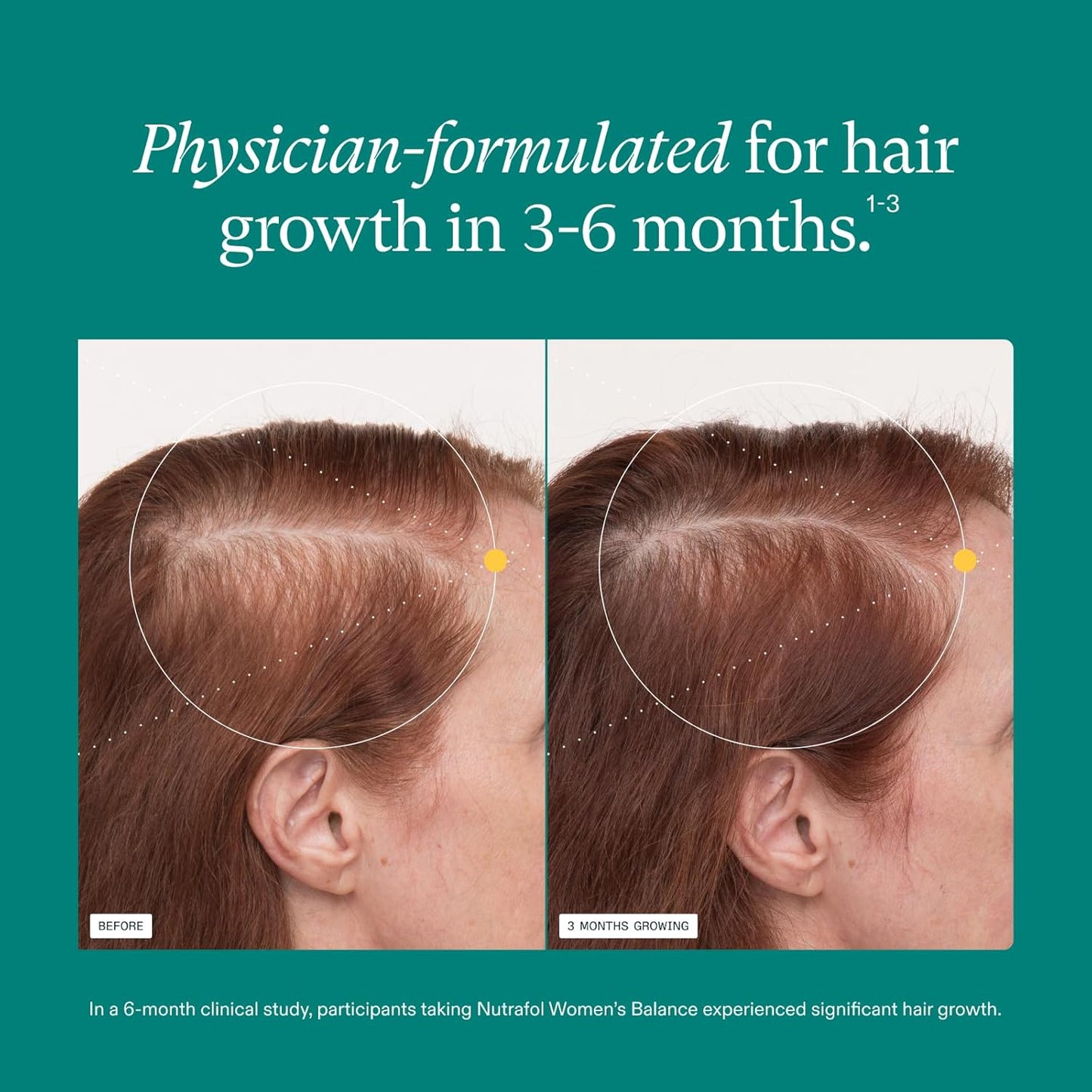 Nutrafol Women's Balance Hair Growth Supplements, Ages 45 and Up, Clinically Proven for Visibly Thicker Hair and Scalp Coverage, Dermatologist Recommended - 1 Month Supply Nirvana Guru