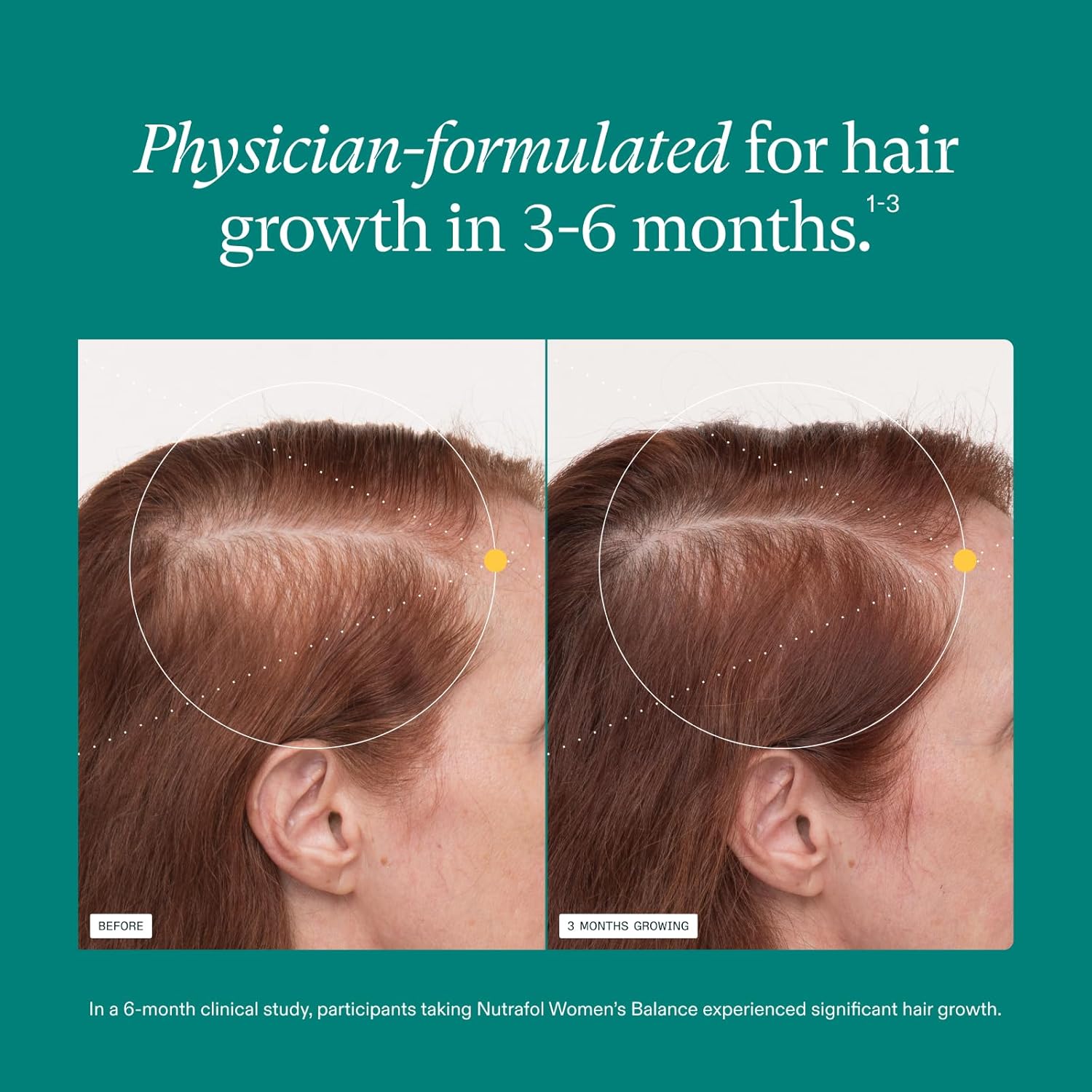 Nutrafol Women's Balance Hair Growth Supplements, Ages 45 and Up, Clinically Proven for Visibly Thicker Hair and Scalp Coverage, Dermatologist Recommended - 1 Month Supply Nirvana Guru