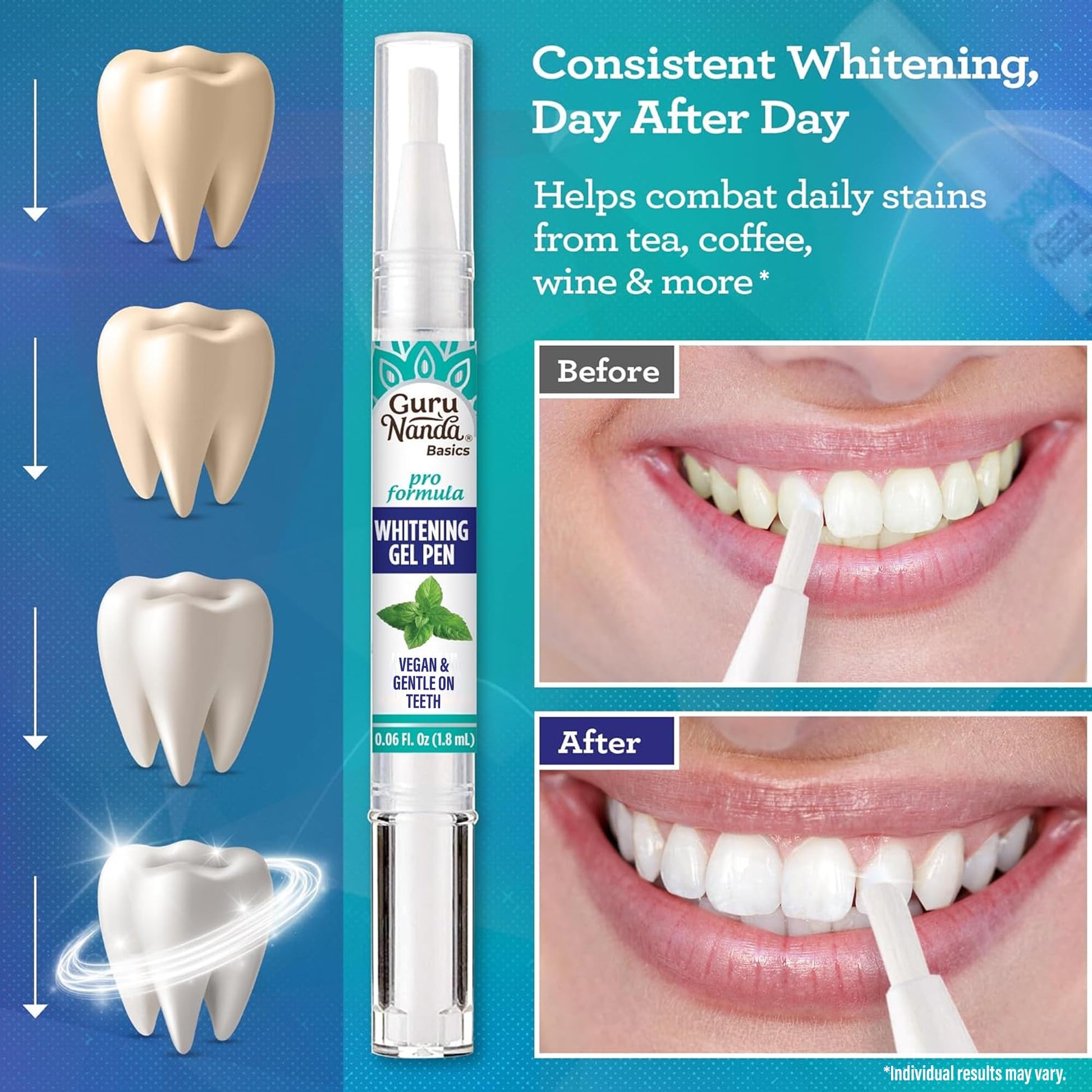 GuruNanda Teeth Whitening Pen,(0.06 fl oz)-20 Uses, Vegan & Gentle on Teeth Pro Formula - Hydrogen Peroxide Whitening Gel Pen, Cruelty-free, Mint Flavor Nirvana Guru