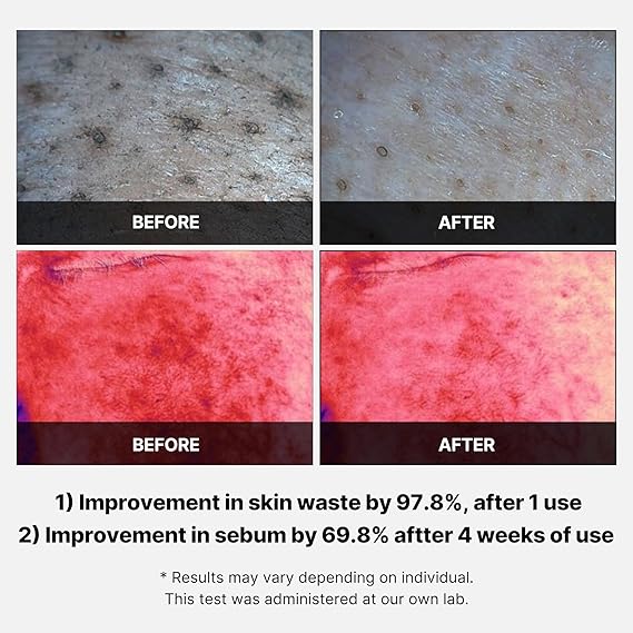 Medicube Red Succinic Acid Exfoliating Peeling Pads for Acne-Prone Skin – AHA, BHA, Niacinamide & Panthenol nirvanaguru