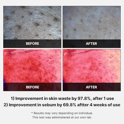 Medicube Red Succinic Acid Exfoliating Peeling Pads for Acne-Prone Skin – AHA, BHA, Niacinamide & Panthenol nirvanaguru