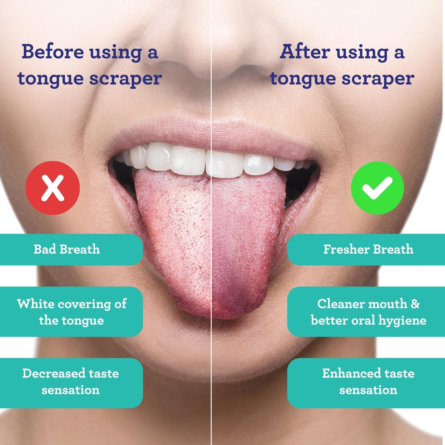 GuruNanda Tongue Scraper for Adults (2 Pack) with Travel Case, 420 Medical-Grade 100% Stainless Steel Tongue Cleaner, Aids in Fresh Breath & Oral Care Nirvana Guru
